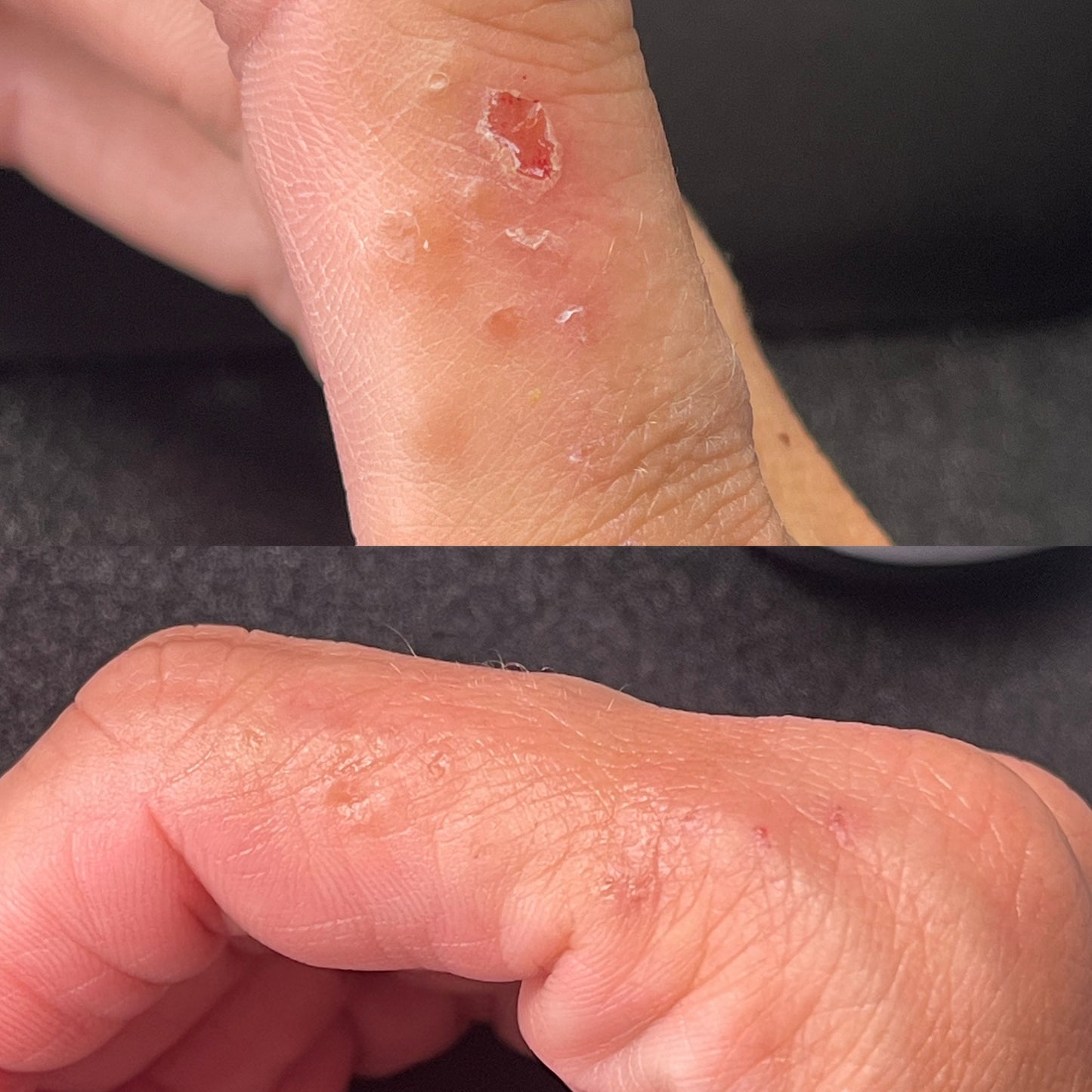 Meadow Mend Eczema Creamy Balm
